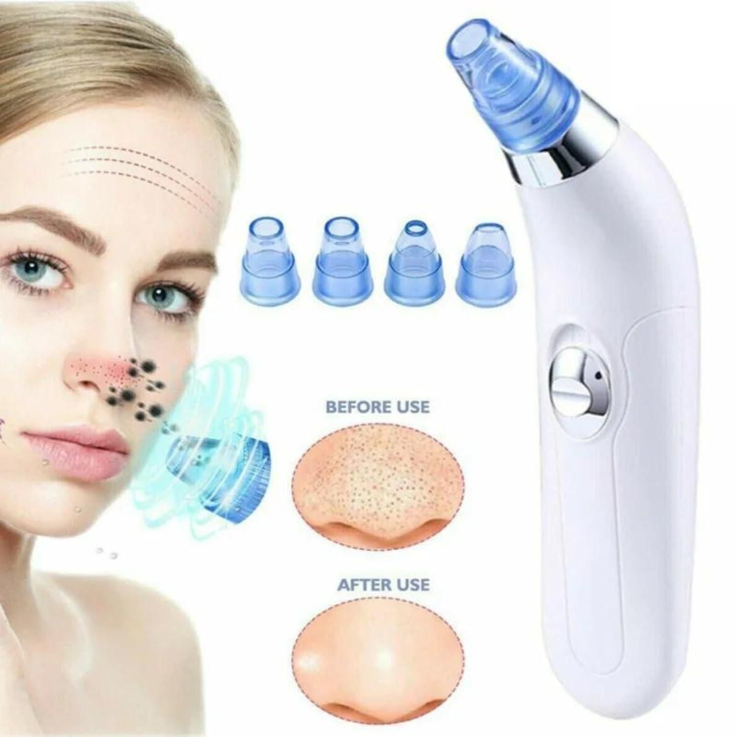 Multi Functional Blackhead Remover