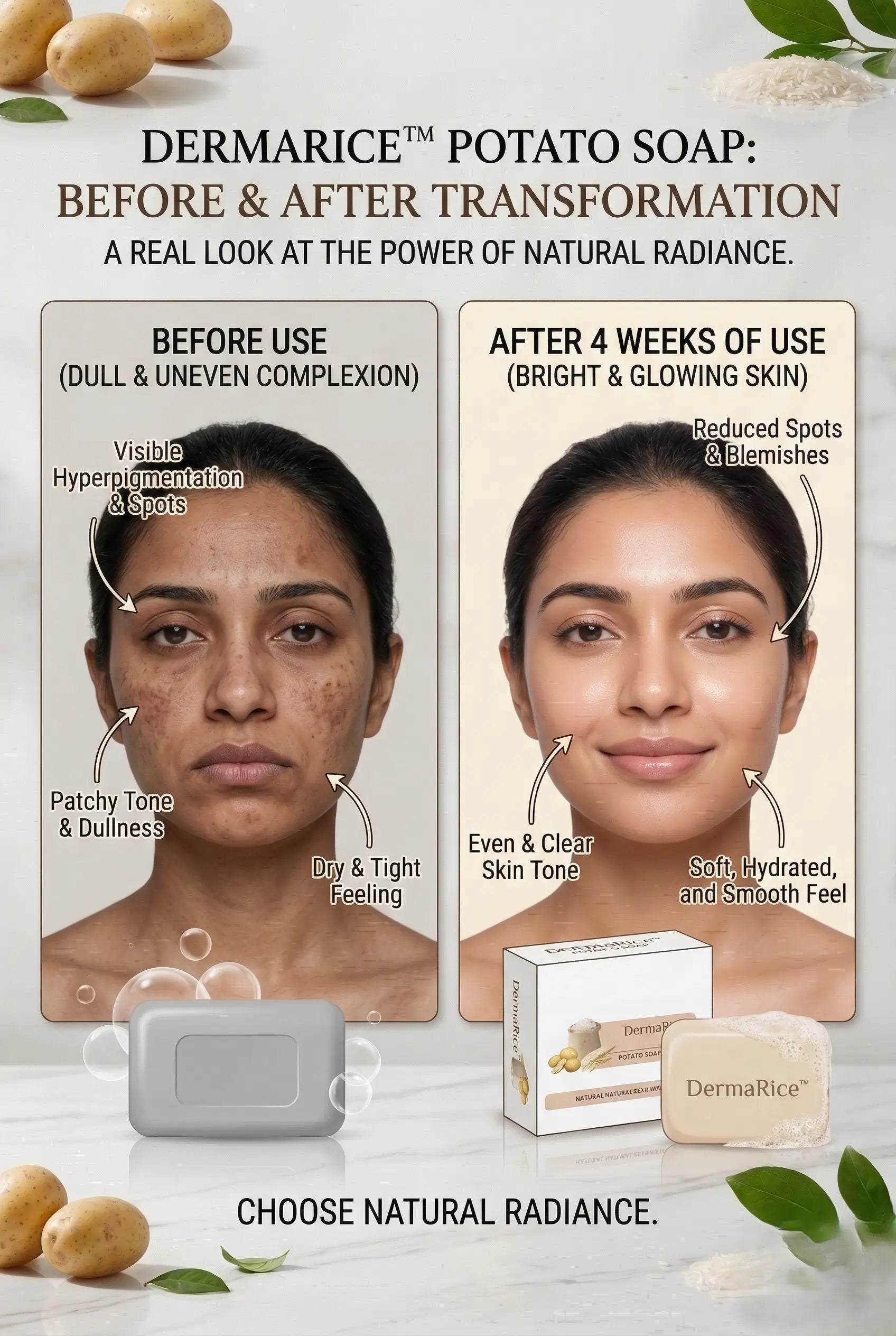 DermaRice™ Potato Brightening Soap – Tan Removal & Skin Glow Bath Bar (100g Each | Buy 1 Get 1 | Deep Cleansing Soap for Face & Body